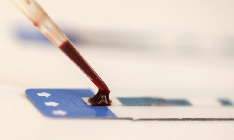 Pesquisadores desenvolvem nova abordagem para combater vírus da aids