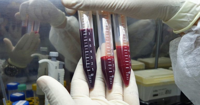 Estudo pode impulsionar desenvolvimento de vacinas e tratamentos para malária
