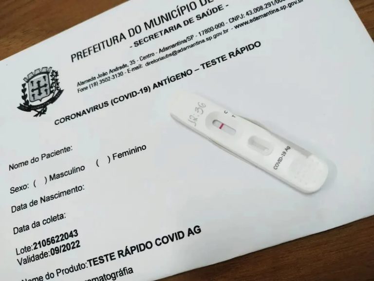 Covid: 12% dos testes realizados no comércio deram positivo
