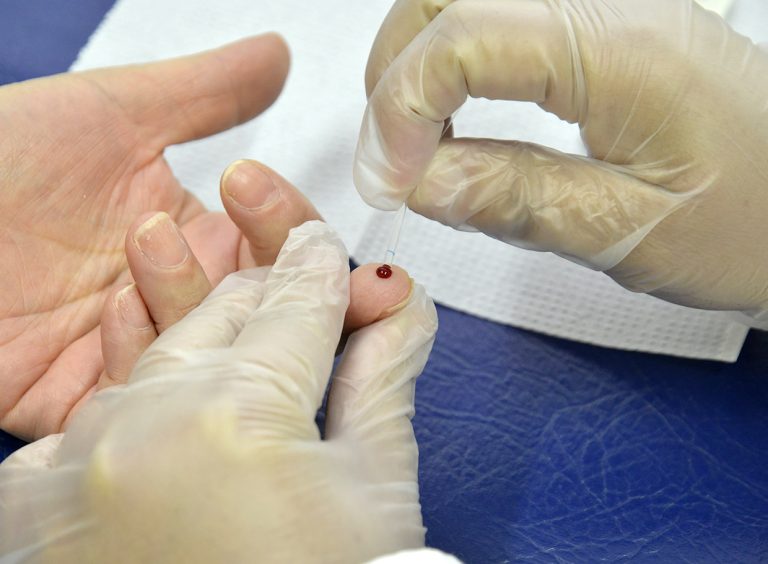 Testagem do HIV e sífilis segue nesta semana nos postos de saúde