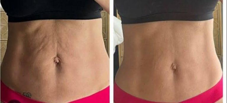 Tudo para valorizar a sua beleza: estética e harmonização corporal