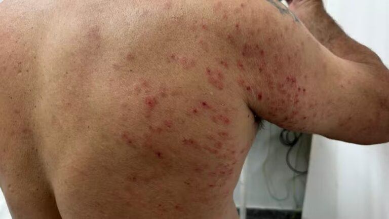 Homem sofre ataque de abelhas durante roçagem em área verde de Osvaldo Cruz