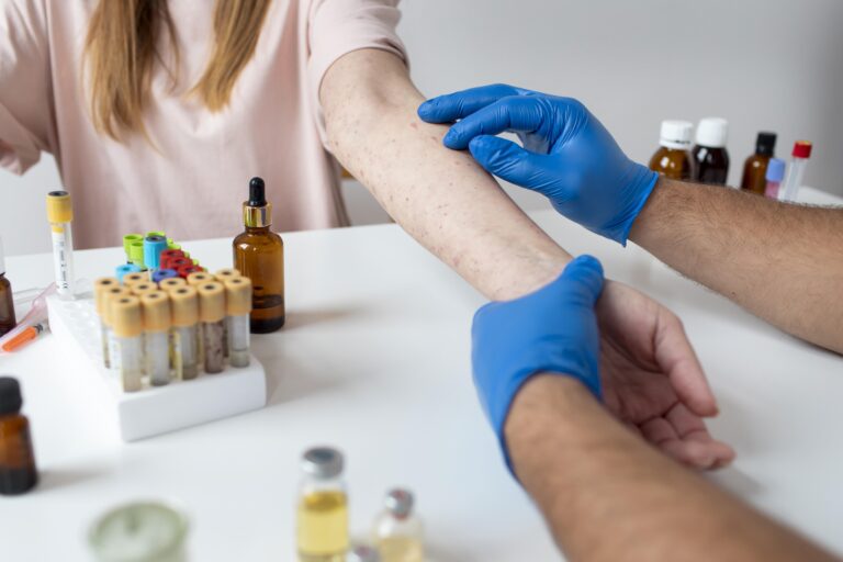 SUS passa a oferecer teste rápido de dengue nos primeiros dias de sintomas